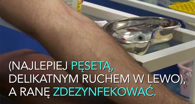 Ugryzienie kleszcza grozi nie tylko boreliozą (WIDEO)
